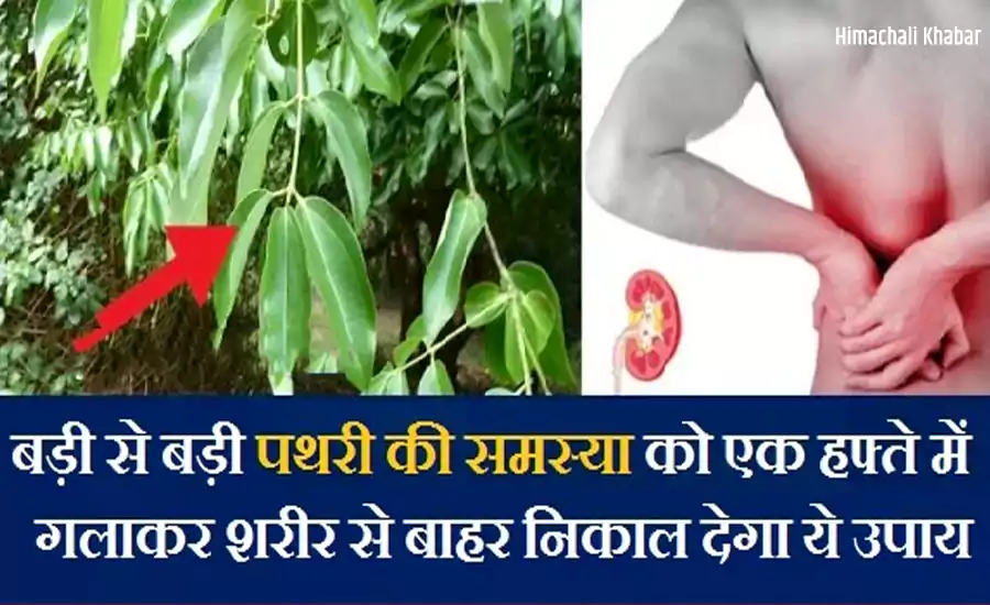 बड़ी से बड़ी पथरी की समस्या को एक हफ्ते में गलाकर शरीर से बाहर निकाल देगा ये चमत्कारी उपाय, शेयर जरूर करें बड़ी से बड़ी पथरी की समस्या को एक हफ्ते में गलाकर शरीर से बाहर निकाल देगा ये चमत्कारी उपाय, शेयर जरूर करें