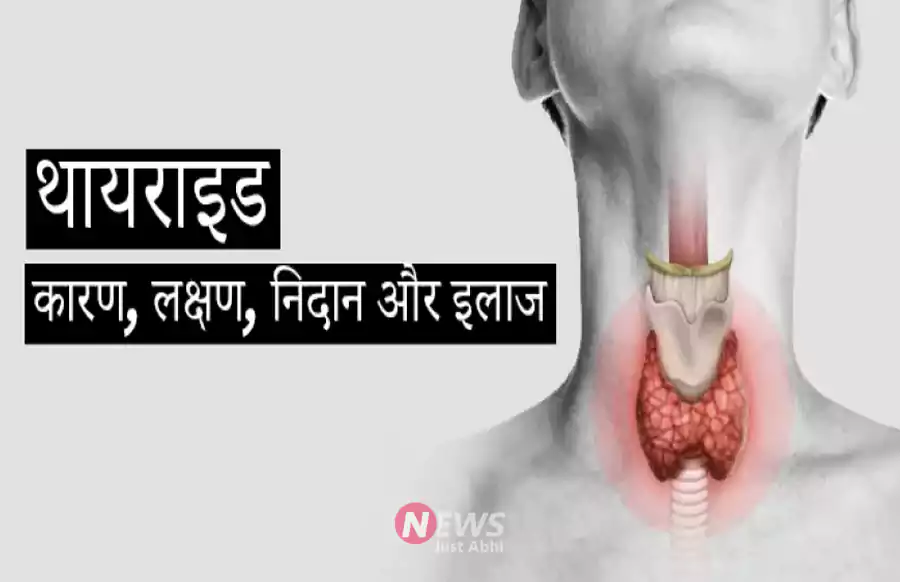 थाइराइड का सबसे आसान अचूक उपाय जो सिर्फ 15 दिनों में अद्भुत परिणाम देगा, जरूर अपनाएँ और शेयर करे थाइराइड का सबसे आसान अचूक उपाय जो सिर्फ 15 दिनों में अद्भुत परिणाम देगा, जरूर अपनाएँ और शेयर करे